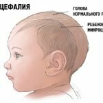 уменьшение головы